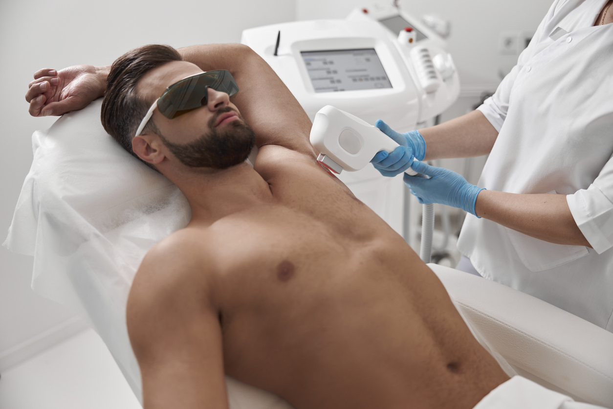 depilação a laser para homens