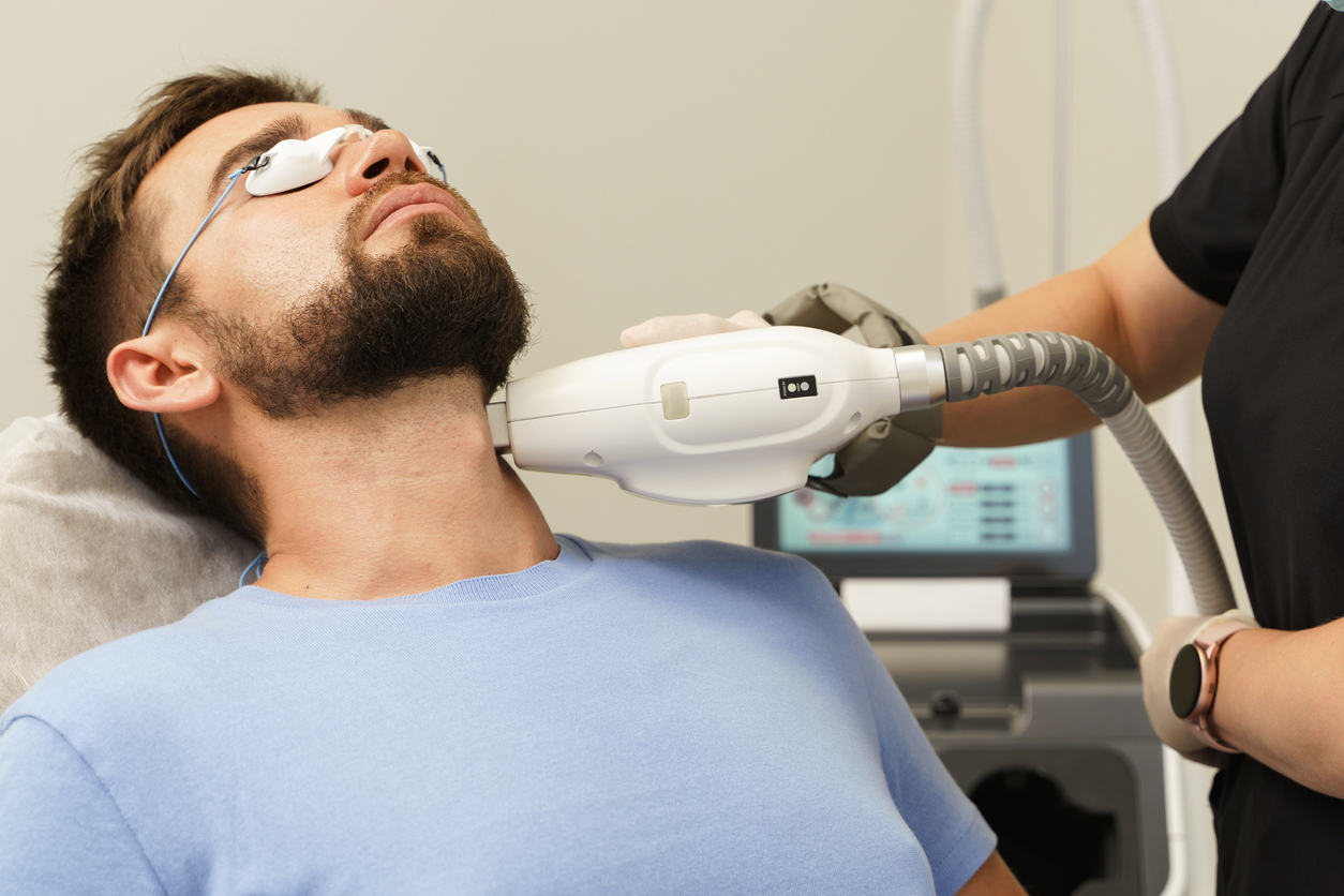 Entenda como funciona a depilação a laser da barba de forma fácil